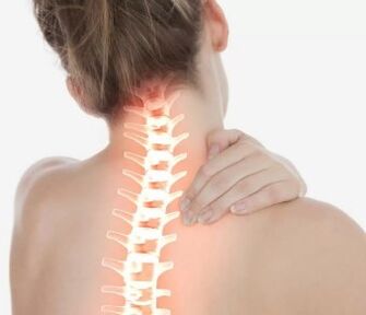 Cervikalna osteohondroza