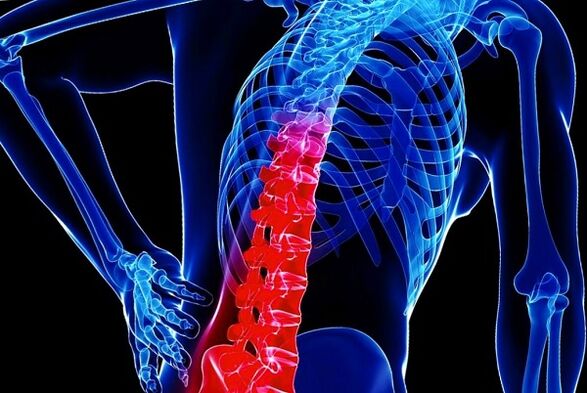 Razlozi razvoja torakalne osteohondroze